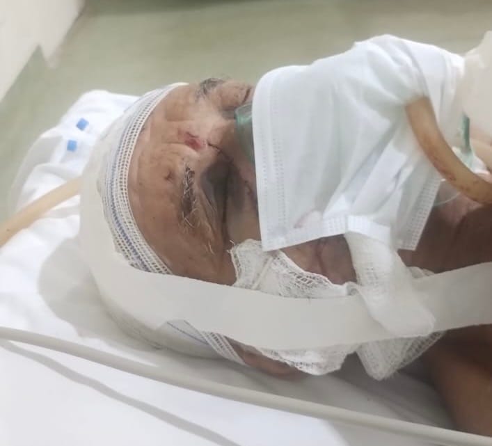 Homem que tentou matar idoso em Várzea Grande se entrega em Cuiabá, confessa crime brutal e é liberado horas depois