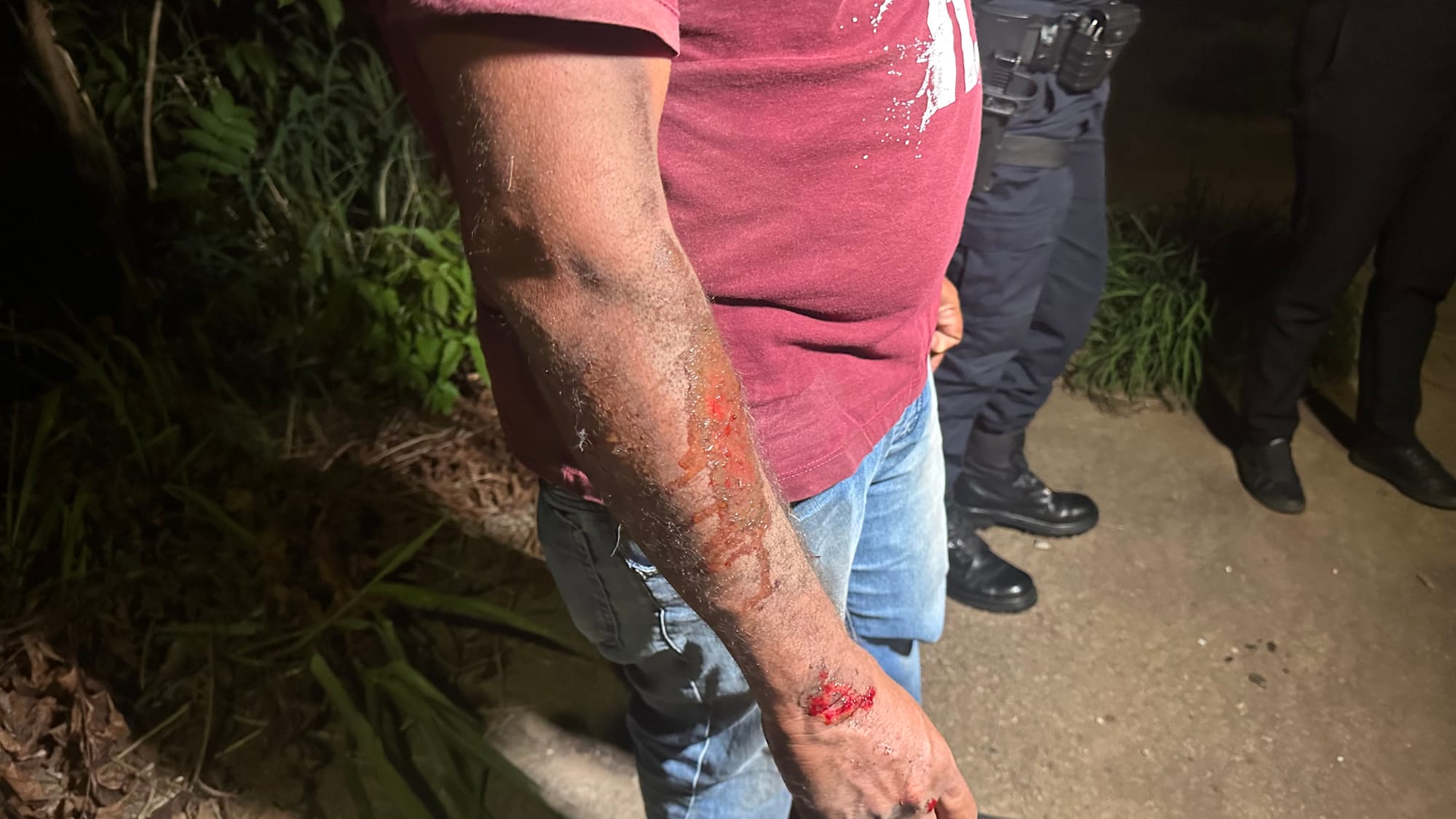 NESTE MOMENTO: Moto de alta cilindrada atinge moto por aplicativo e deixa três feridos na Avenida do CPA