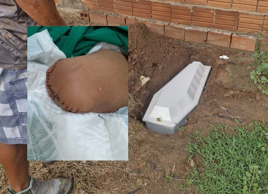 10 DIAS DEPOIS DO ENTERRO, HOSPITAL LIGA PARA FAMÍLIA BUSCAR PERNA DE JOVEM MORTO APÓS ACIDENTE
