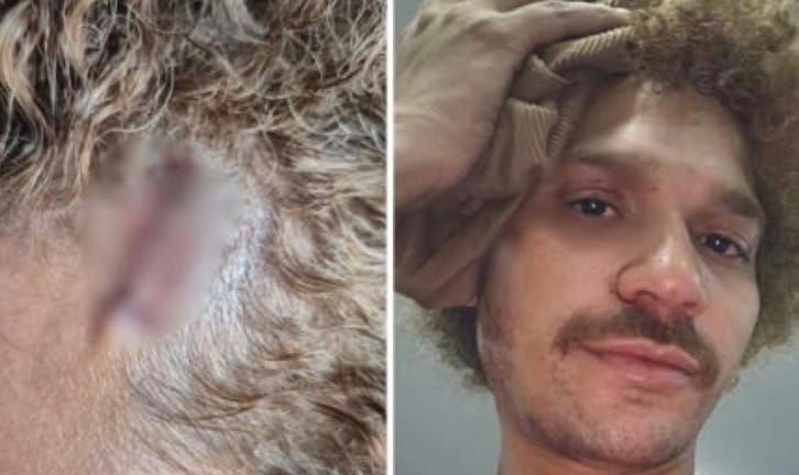 Professor denuncia perseguição, racismo e agressão de vizinho em Cuiabá