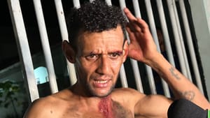 Amigo de infância agride homem com barra de ferro após recusa em roubo para trocar por drogas em Várzea Grande