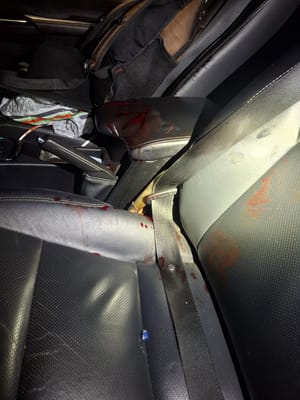 EXECUTADO A TIROS: HOMEM DE 34 ANOS MORRE APÓS PEDIR SOCORRO