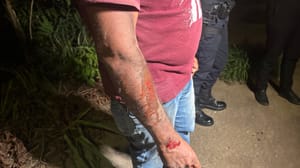 NESTE MOMENTO: Moto de alta cilindrada atinge moto por aplicativo e deixa três feridos na Avenida do CPA