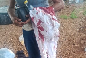 URGENTE: PM evita feminicídio embaixo de viaduto e prende homem com passagem por homicídio em Cuiabá