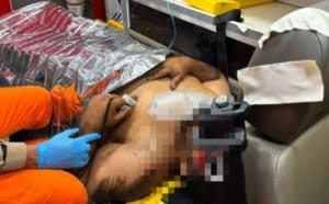 CAMINHONEIRO ESCAPA DA MORTE APÓS SER PRENSADO DURANTE REPARO EM VEÍCULO NA BR-174 EM CÁCERES
