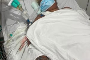 DRAMA NA SAÚDE: Mulher com AVC hemorrágico luta pela vida enquanto espera vaga de UTI em Cuiabá