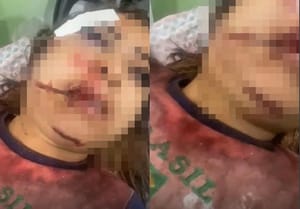 🚨 Garota de programa é atraída por cliente, espancada e quase morta em Várzea Grande; suspeito é preso